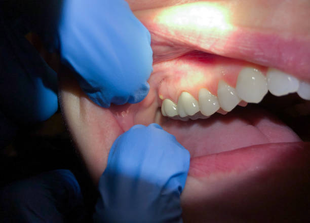Best Weekend Emergency Dentist in Shenandoah, IA